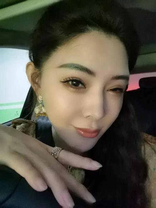 腰腹吸脂前后对比图集 美丽新篇章 效果见证在2026年 腰腹吸脂前后对比图集 美丽新篇章 效果见证在2026年