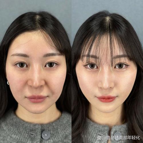 顽固脂肪肚子怎么减肥 顽固脂肪肚子怎么减肥