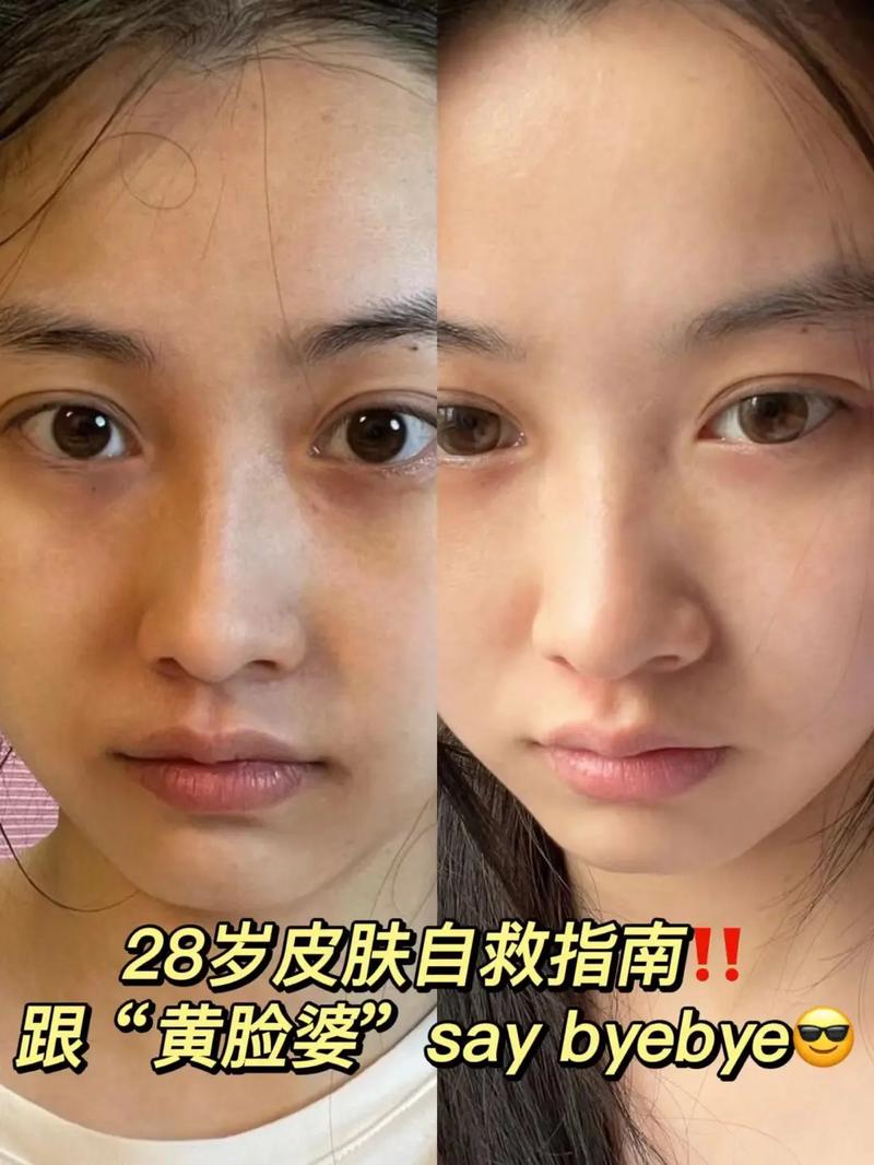 减肥能吃香蕉吗热量多吗 减肥能吃香蕉吗 减肥能吃香蕉吗热量多吗 减肥能吃香蕉吗