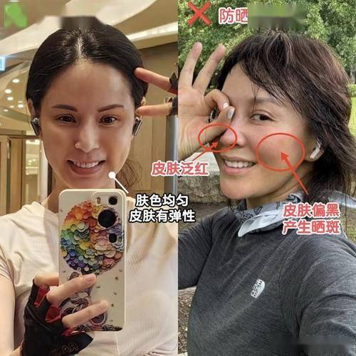 女人抽脂肪对身体有害吗 女人抽脂肪对身体有害吗